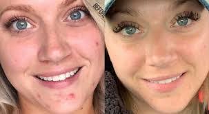 Brooke Cohoon's Instagram, Twitter & Facebook