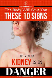 The Body Will Give You These 10 Signs If Your Kidney Is In Danger Via Dailyhealthpost Healthy Detox Kidney Health Kidney Cleanse