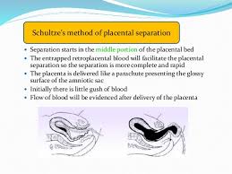 About one in 100 pregnancies can have placental abruption, which is one of the significant risks during late placental abruption, premature separation of placenta or detached placenta, is a rare but. 006 Management Of The Third Stage Of Labor