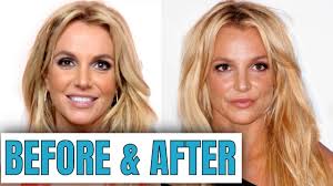 The toxic singer opened up about her ambitions for the new year on instagram on thursday alongside a in 2020 i will be doing a lot more acro yoga and the basics for yoga …. Britney Spears Plastic Surgery 2020 Youtube