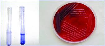 Congo red agar test showing four different slime producing patterns of clinical mrsa isolates: Biofilm Detection By Tube Method And Congo Red Agar Method Download Scientific Diagram