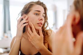 Pimples: How Long Do They Last and How Do They Form?