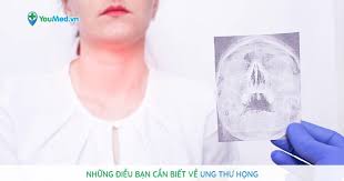 We did not find results for: Nhá»¯ng Ä'iá»u Báº¡n Cáº§n Biáº¿t Vá» Ung ThÆ° Há»ng Youmed