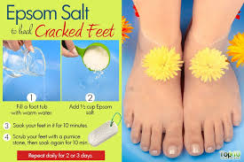 That's why you need to take extra care of your feet to avoid dry, cracked heels. How To Heal Cracked Feet Top 10 Home Remedies