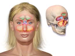 Sinusitis Wikipedia