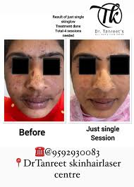 Dr Tanreet's Skin Hair & Laser Center in Amritsar Colony,Amritsar