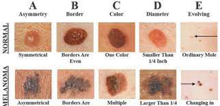 You may also notice more hair growing or itchy skin. Skin Cancer Dermatologist In Bethesda Md
