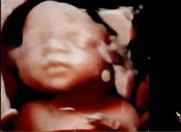 Love At First Sight 3D-Berwick