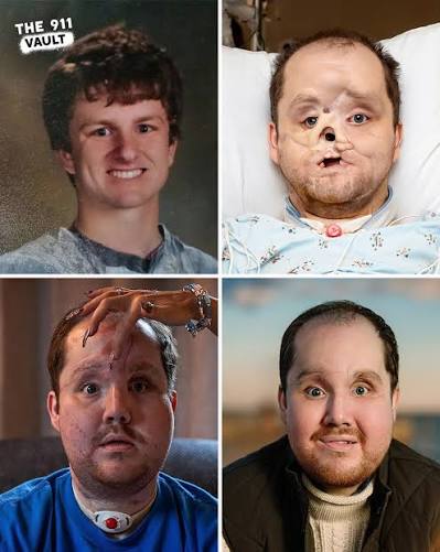 The 911 - In 2014, college student Derek Pfaff from Michigan survived a  self-inflicted g*nsh*t that destroyed much of his face, leaving him unable  to speak, eat, or breathe normally. When Pfaff