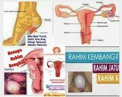 Penyakit rahim bengkak bisa saja gede penyebab rahim bengkak akibat infeksi kepada rahim, infeksi terhadap rahim bukanlah faktor yg sepele dikarenakan jikalau infeksi di rahim dibiarkan bisa menjalar. Kekal Sihat Bersama Jsd Posts Facebook