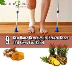 9 Best Home Remedies For Broken Bones That Gives Fast Relief Broken Bone Heal Broken Bones Bone Healing