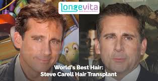 World's Best Hair: Steve Carell Hair Transplant