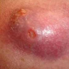 Ruyada Irin Gormek Ne Anlama Gelir