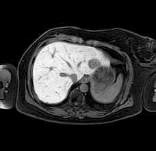 Furthermore, this reduction in stress may alleviate high blood pressure and reduce pulse rate for the apprehensive patient. Bildergalerie Radiologie