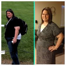 Some people reach their weight loss goal within a year or are close to reaching it, but not everyone will. Gastric Sleeve Surgery Gastric Sleeve Sleeve Surgery Gastric Sleeve Surgery