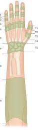 Image result for Extensor Tendon Laceration
