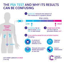 Why A One Off Psa Test For Prostate Cancer Is Doing Men More