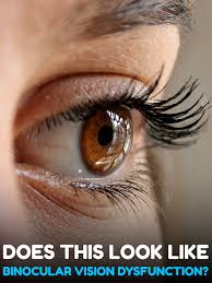 Understanding Binocular Vision Dysfunction Tests