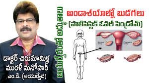 Poly Cystic Ovary Disease Pcos Prof Dr Murali Manohar Chirumamilla M D Ayurveda Youtube