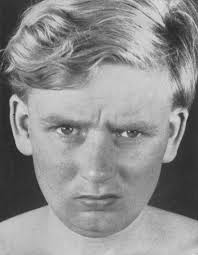 Das hypophysäre Cushing-Syndrom