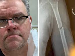 Fundraiser by Regie Hamm : Regie's busted arm fund