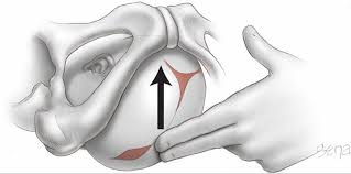 At this stage, if there is effacement and dilatation, the woman is in labour; Normal Labor Williams Obstetrics 24th Edition