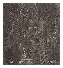 Image result for Phragmanthera capitata