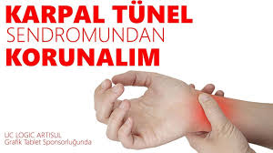 Karpal Tunel Sendromundan Korunalim Karpal Tunel Sendromu Carpal Tunnel Akupresur Noktalari