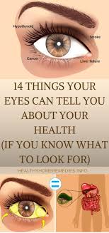 14 Things Your Eyes Can Tell You About Your Health If You Know What To Look For Healthy Blog Eye Health Healthy Blogs Told You So
