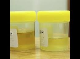 شكل بول الحامل اشكال البول الخاص بالحوامل كيف