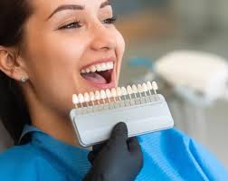 Veneers Henderson, NV