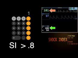 Image result for Shock Index