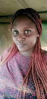 Dog loses eye saving owner from armed robber, still beautiful?