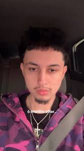 Moving After Tlif Fusion