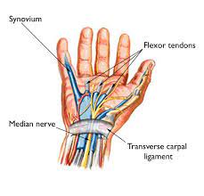 Carpal tunnel syndrome (cts) is a peripheral neuropathy caused by chronic or acute compression of the median nerve by the transverse carpal ligament. Carpal Tunnel Syndrome Symptoms And Treatment Orthoinfo Aaos