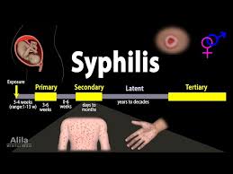 Image result for Cardiovascular Syphilis