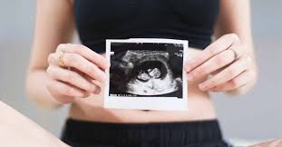 How accurate is my 'due date'? What Does Aua Mean On A Scan Result Bellybelly