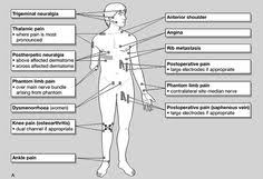 43 Best Tens Images Tens Unit Placement Tens Electrode