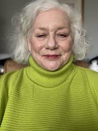 Does anyone know how bad your HS needs to be for the drs to refer to a  dermatologist? I'd say compared to alot of people here I'm reasonably lucky  with my HS,