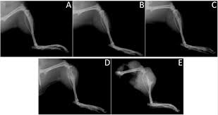 Modeling Primary Bone Tumors and Bone Metastasis with Solid Tumor Graft  Implantation into Bone