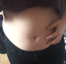 An fettleibigkeit (adipositas) leidet ein hund, wenn er 20 prozent oder mehr über seinem normalgewicht liegt. Habe Ich Schon Ubergewicht Fur Mein Alter Oder Ist Mein Gewicht Noch In Ordnung Zu Dick