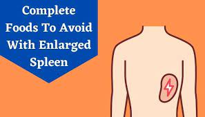 12 Foods To Avoid With Enlarged Spleen - Iifl Insurance