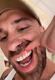 Billy and Awhina's Tooth Gem Prank