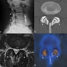 Image result for Low Back Imaging