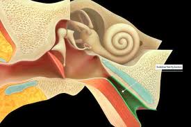 Image result for Eustachian Tube Dysfunction