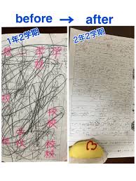 字 が 汚い 発達 障害