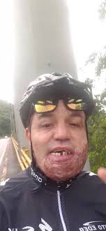 Nelson Garzon Vivir Es Vencer.