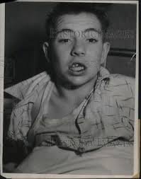 1941 Press Photo Samuel Long.15, beat by Police after "Stealing a ride"