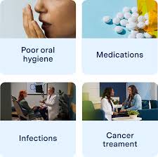 Image result for Metallic Taste