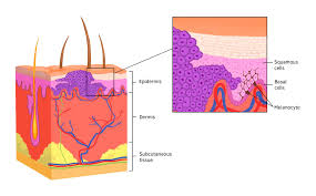Adrenocortical carcinoma the cause of this cancer is unknown. Squamous Cell Carcinoma Health